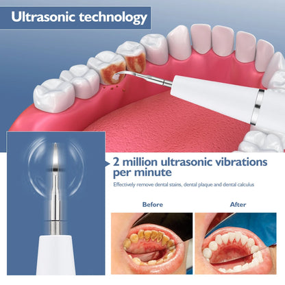 Ultrasonic Electric Dental Plaque Tartar Calculus Remover